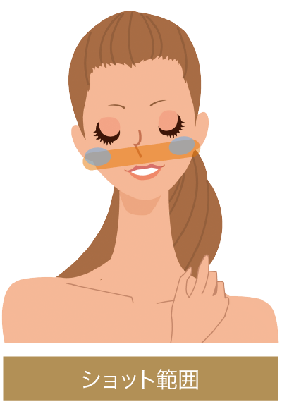 ショット範囲